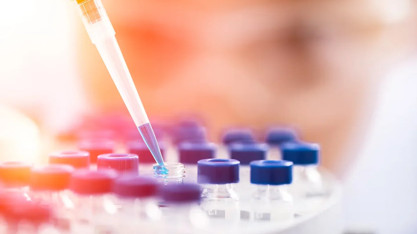 Pipette and laboratory sample containers