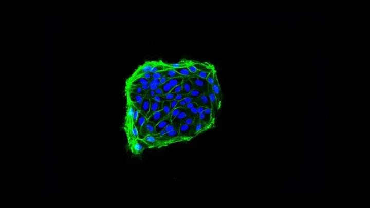 IF staining of human intestinal stem cells. 