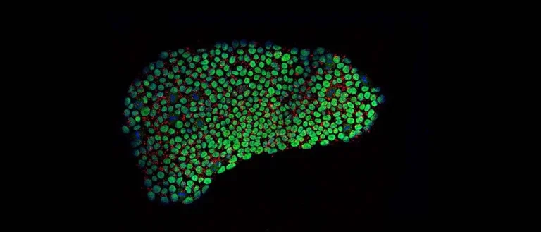 Immunofluorescence staining of patient specific iPSCs.