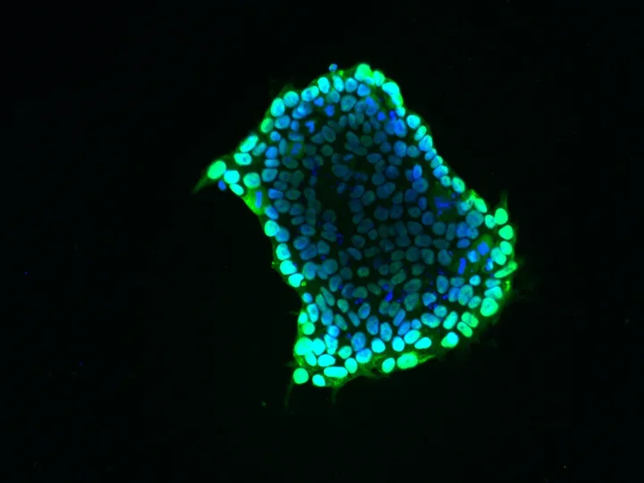 Human intestinal stem cell.