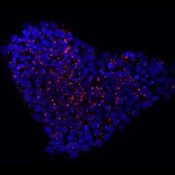 Heart-shaped cluster of iPSCs. 