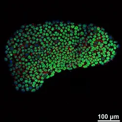 Immunofluorescence staining of patient specific iPSCs.