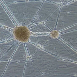 Microscopic view of differentiated cells