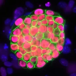 Immunostaining iPSC Colony