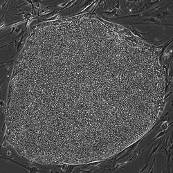 Phase contrast image of an iPSC colony.