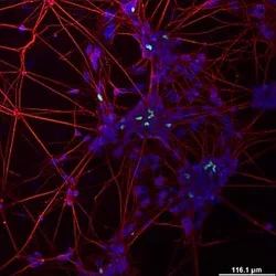 IF imaging of a group of induced motor neurons.