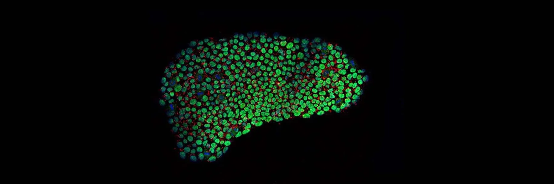 Immunofluorescence staining of patient specific iPSCs.