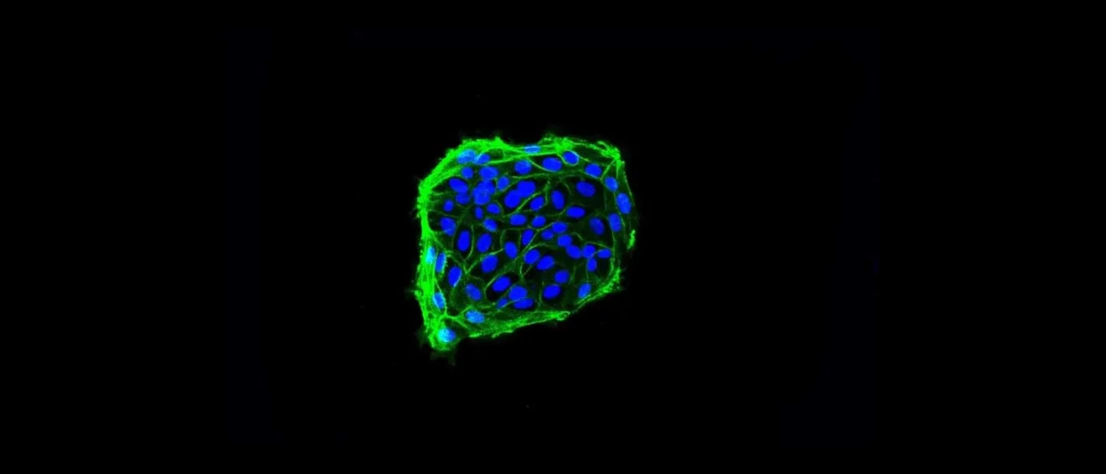IF staining of human intestinal stem cells. 