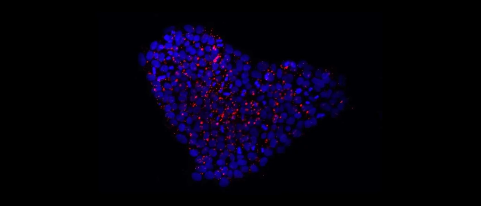 Heart-shaped cluster of iPSCs. 